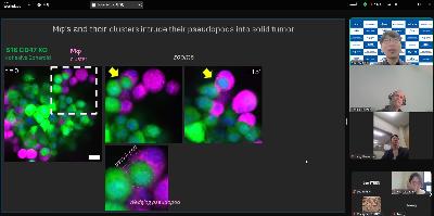 151. Pennsylvania University, Dennis Discher, Mechanobiology and Immune Modulation in Cancer